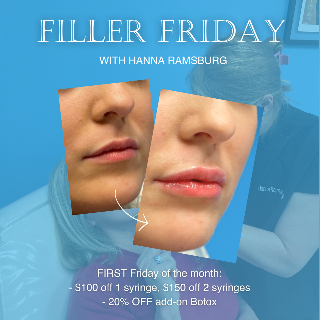 Filler Friday - Offer