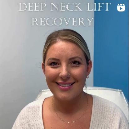 Deep Neck Lift Recovery Before and After