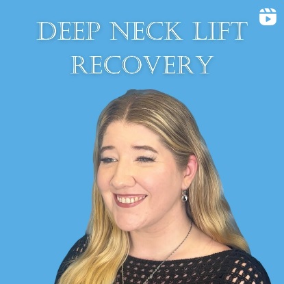 Neck Lift and Eyelid Surgery Before and After